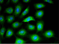 （ibidi）μ-Dish 50 mm低壁培養(yǎng)皿-81136 81131